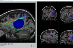 cerebro 4_rsz